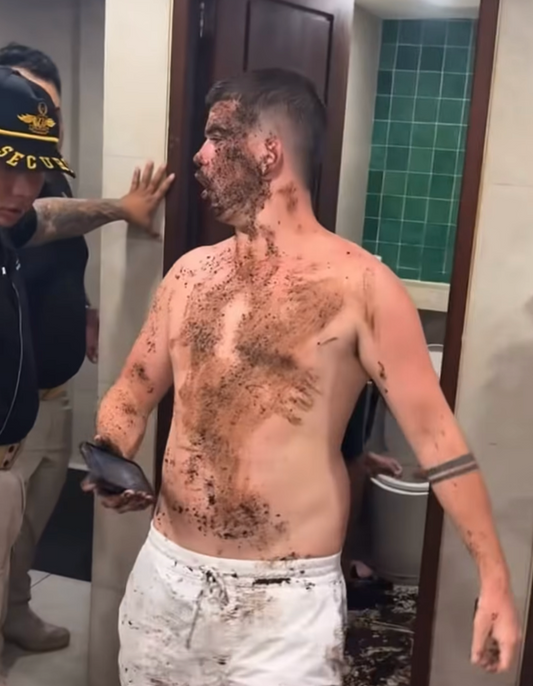 Shit time in bali